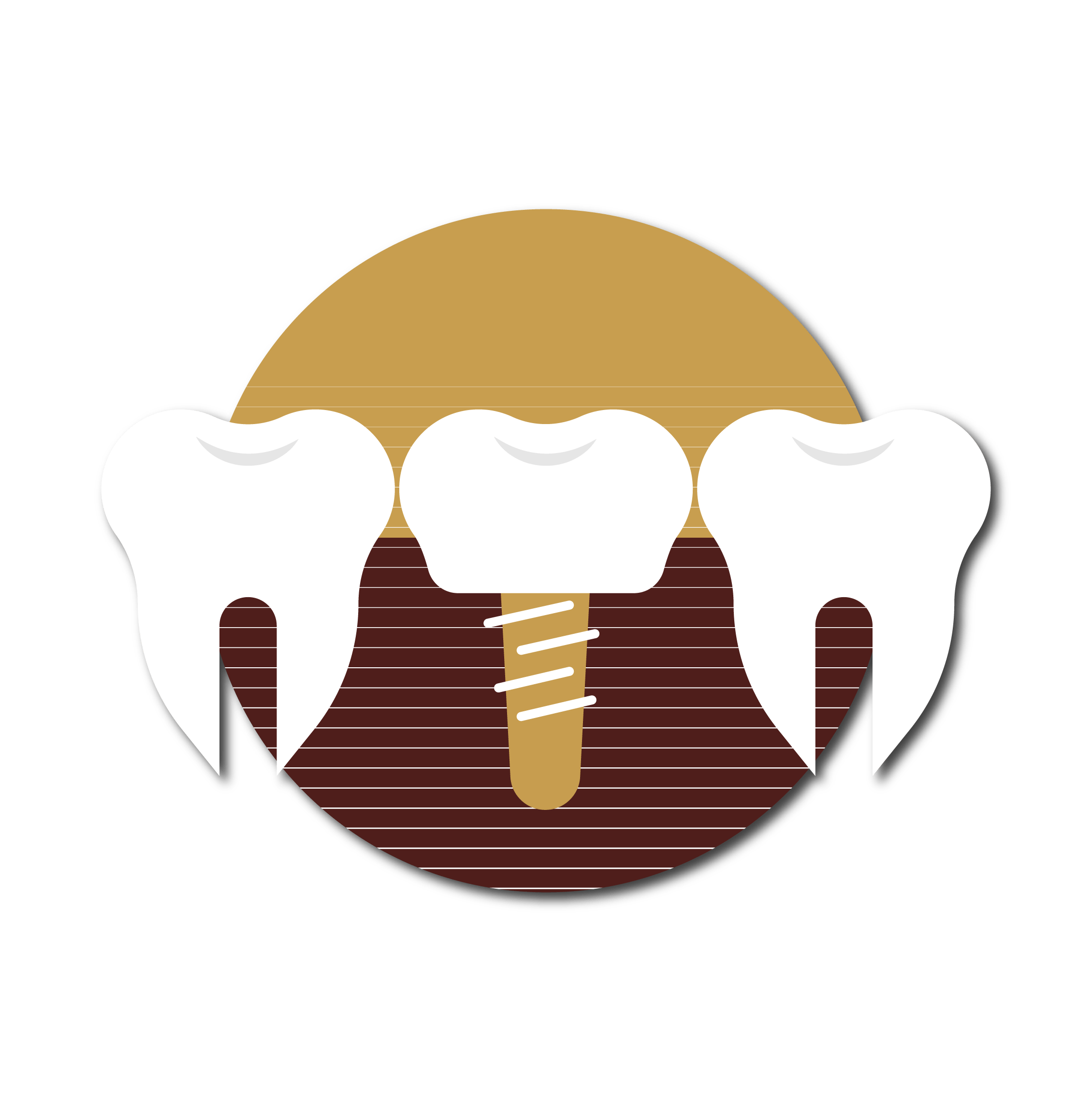 tratamientos-reconstruccion-estetica-cerec-clinicadentalmorenocabello