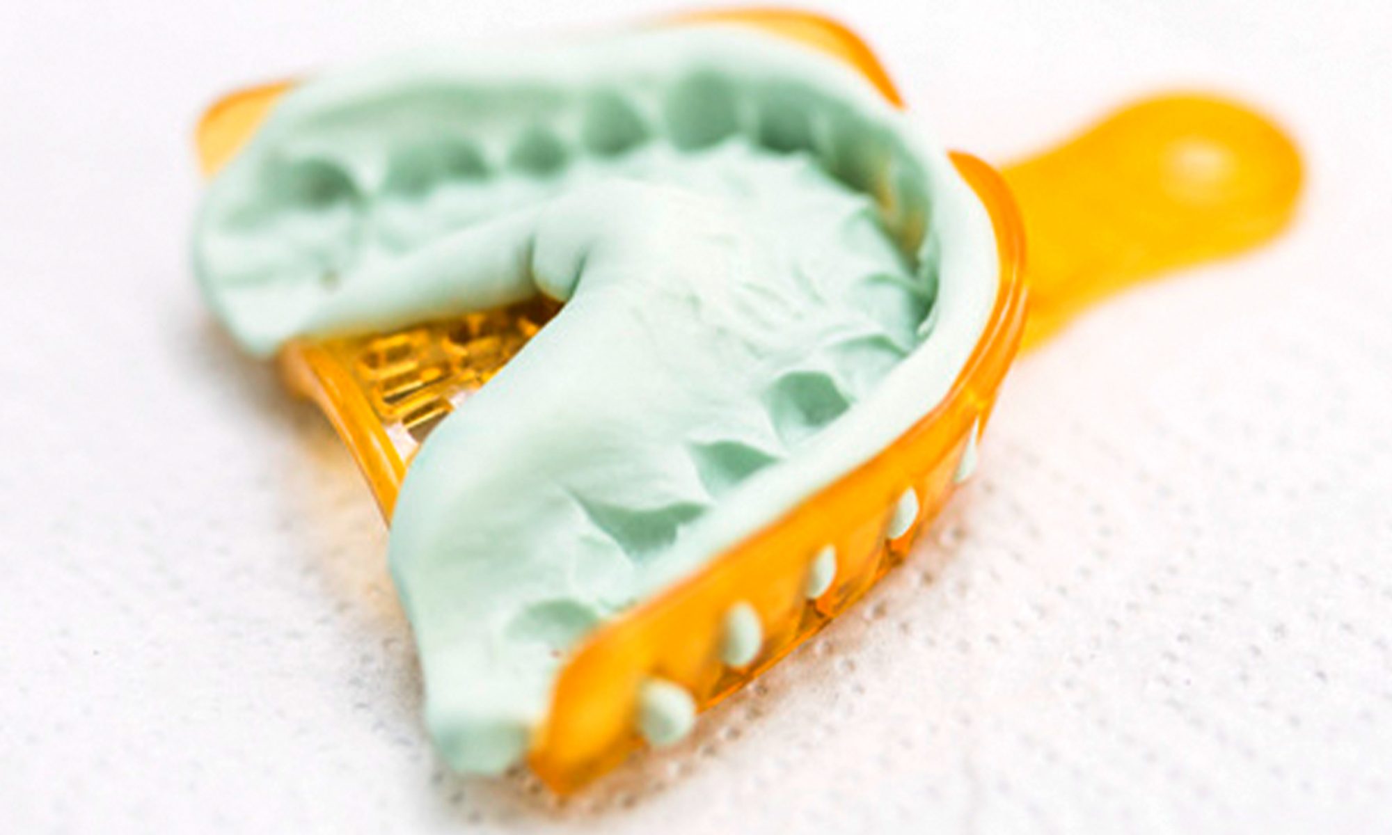 clinicadental-morenocabello-bruxismo