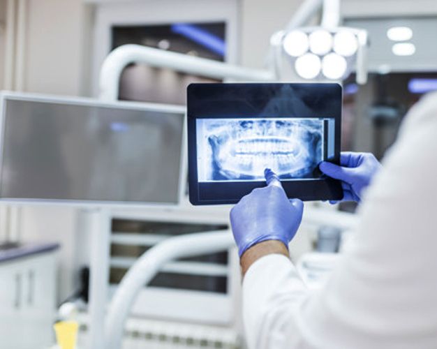 ESCOLIOSIS DENTAL, CRANEAL Y VERTEBRAL