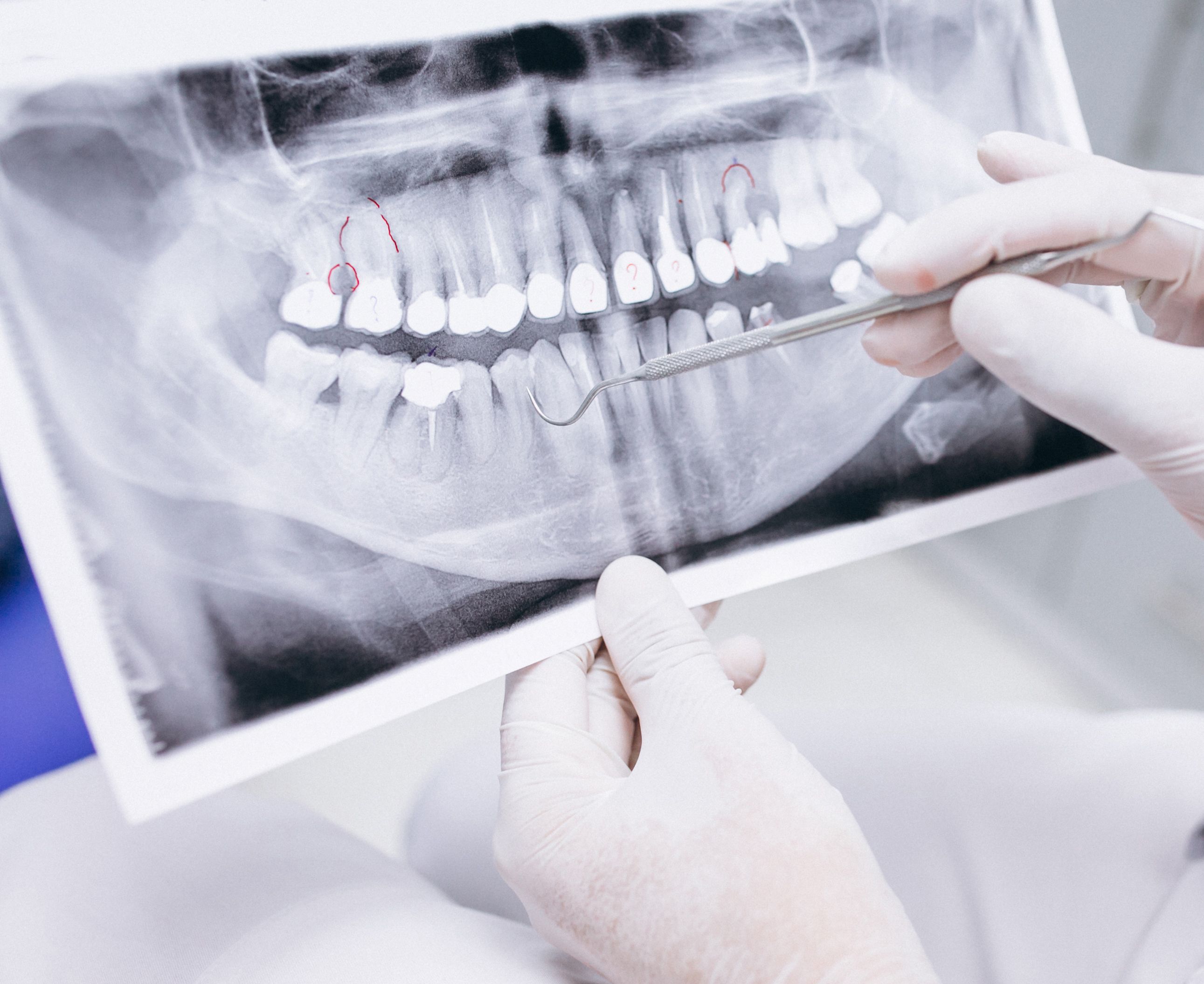 Radiologia-clinica-dental-moreno-cabello