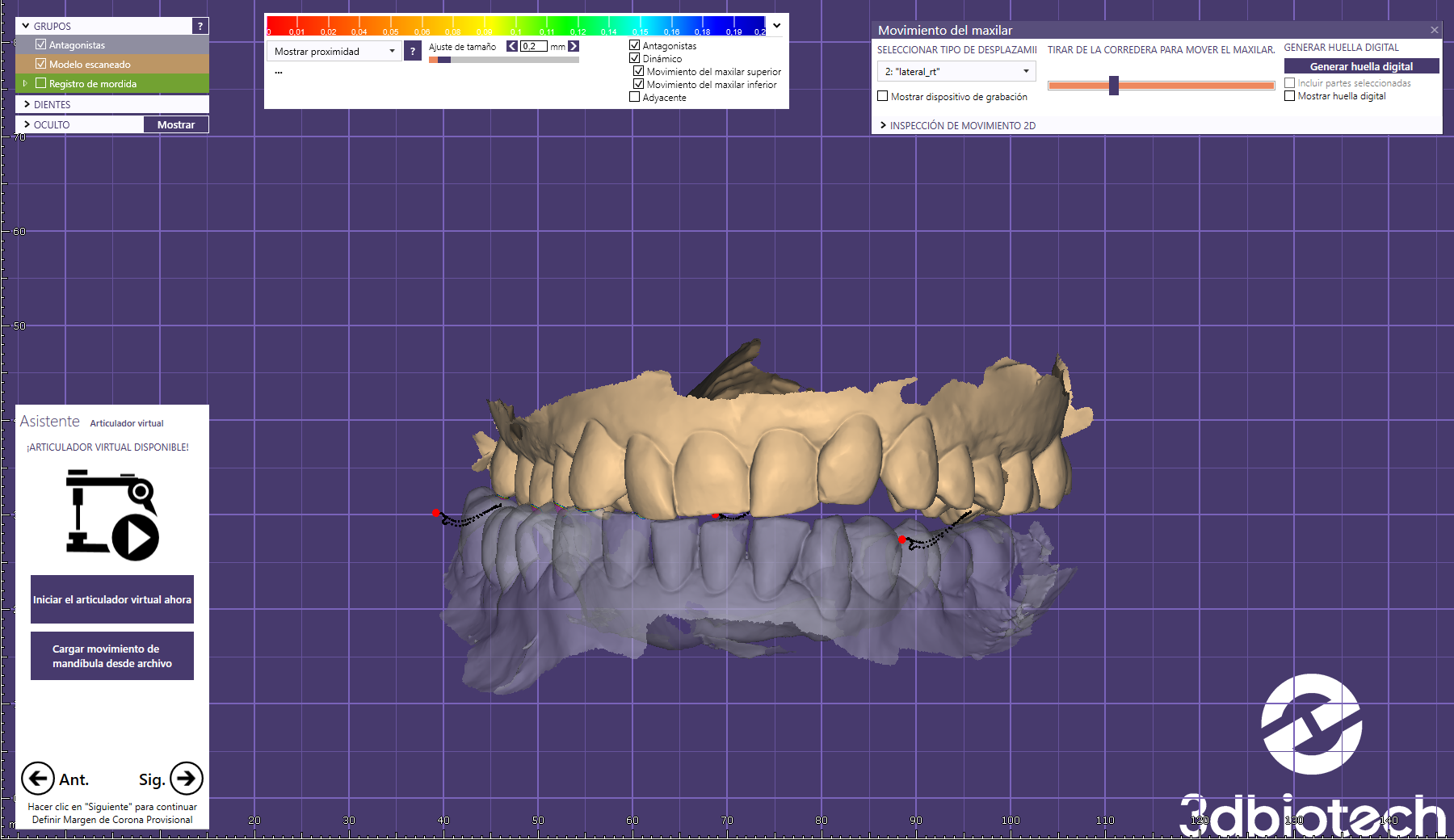 REGISTRO DE OCLUSIÓN DIGITAL