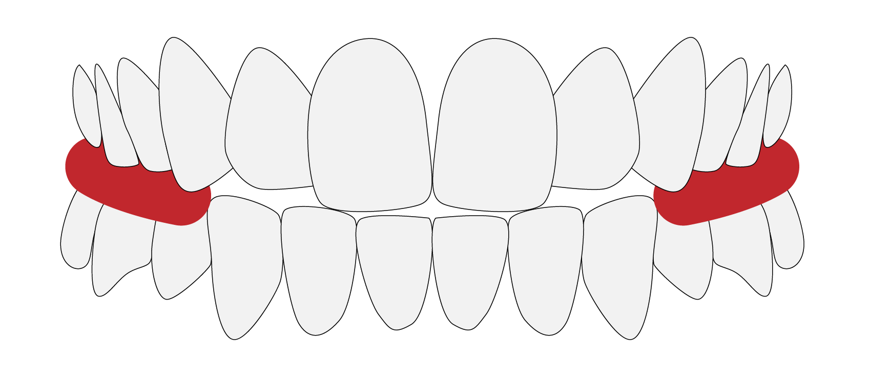 arcada-clinicadentalmorenocabello