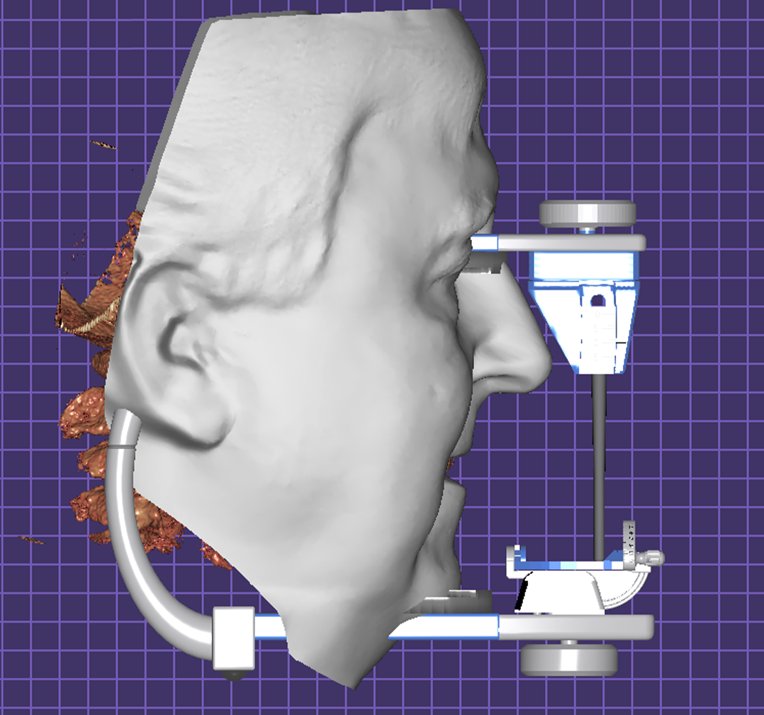 Articulador Dental Virtual (ADV)