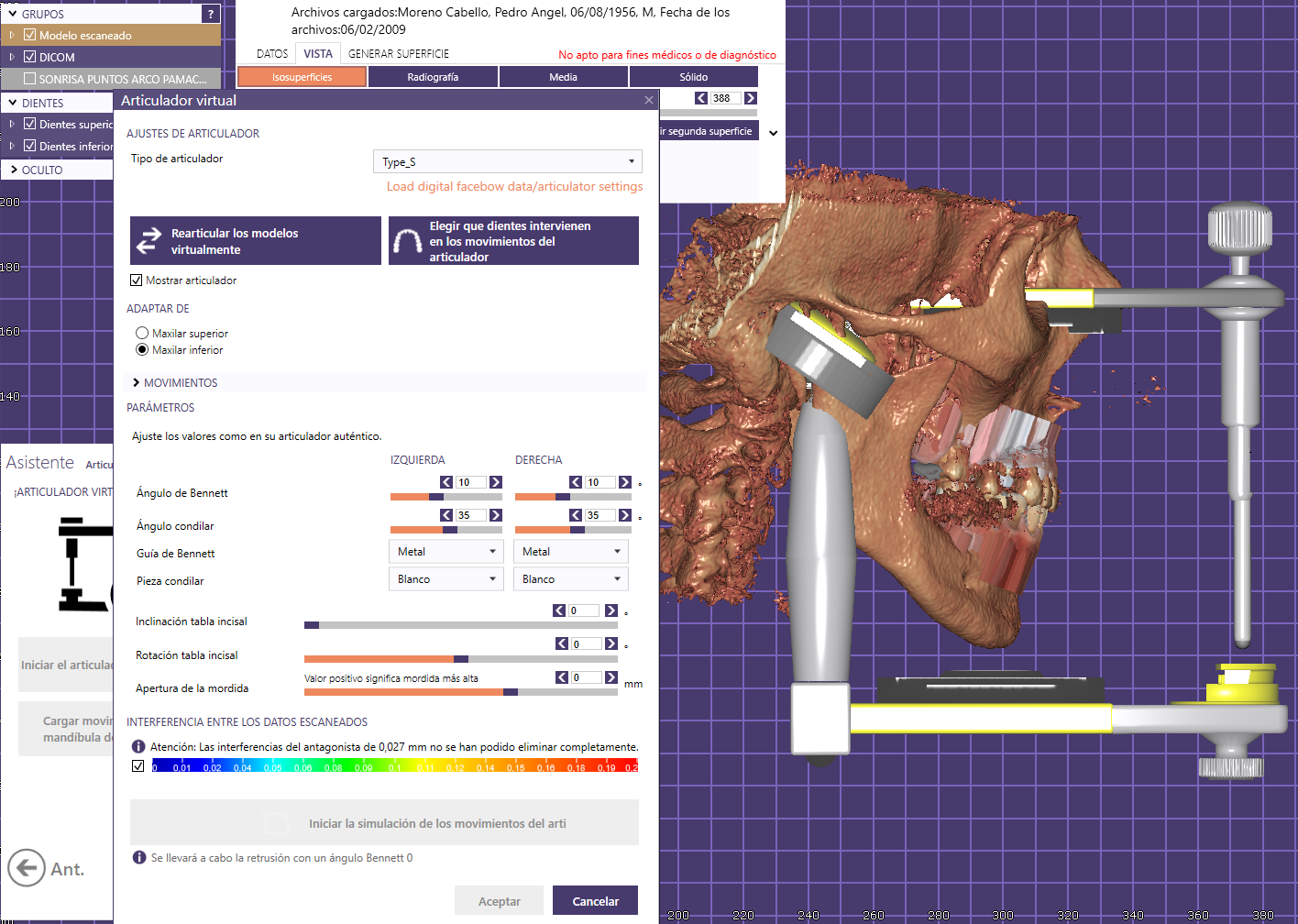 Articulador Dental Virtual (ADV)