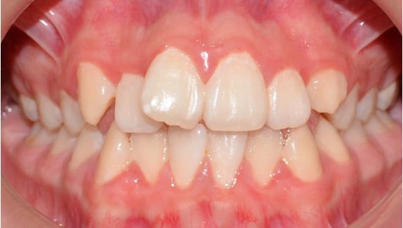 clinica-dental-moreno-cabello-Estetica-y-protesis