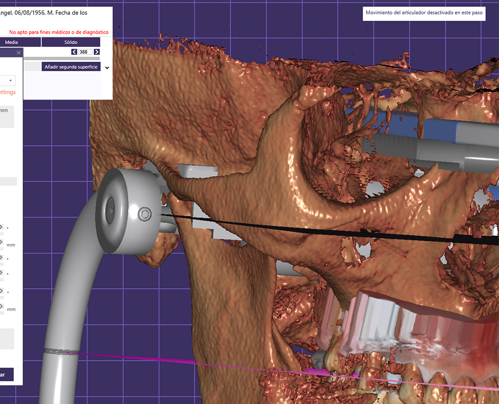 Articulador Dental Virtual (ADV)