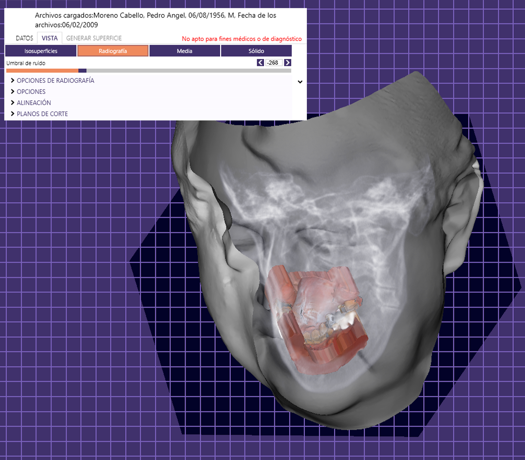 Articulador Dental Virtual (ADV)