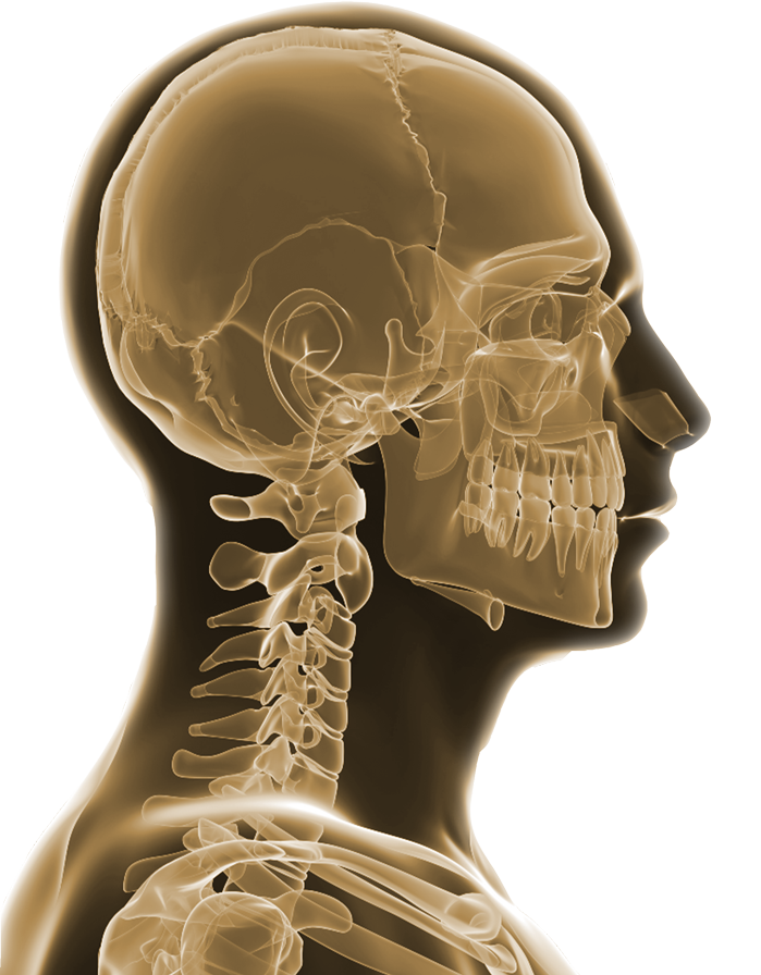 Disfunción Temporomandibular