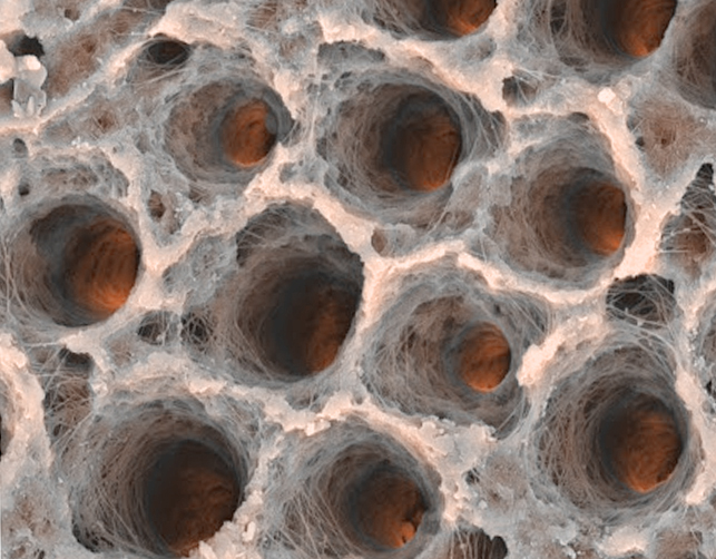 Sensibilidad dental y Laser