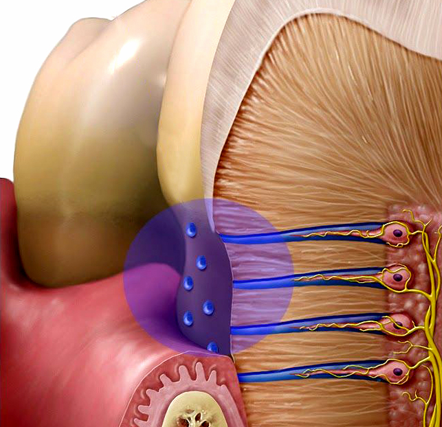 Sensibilidad dental y Laser​