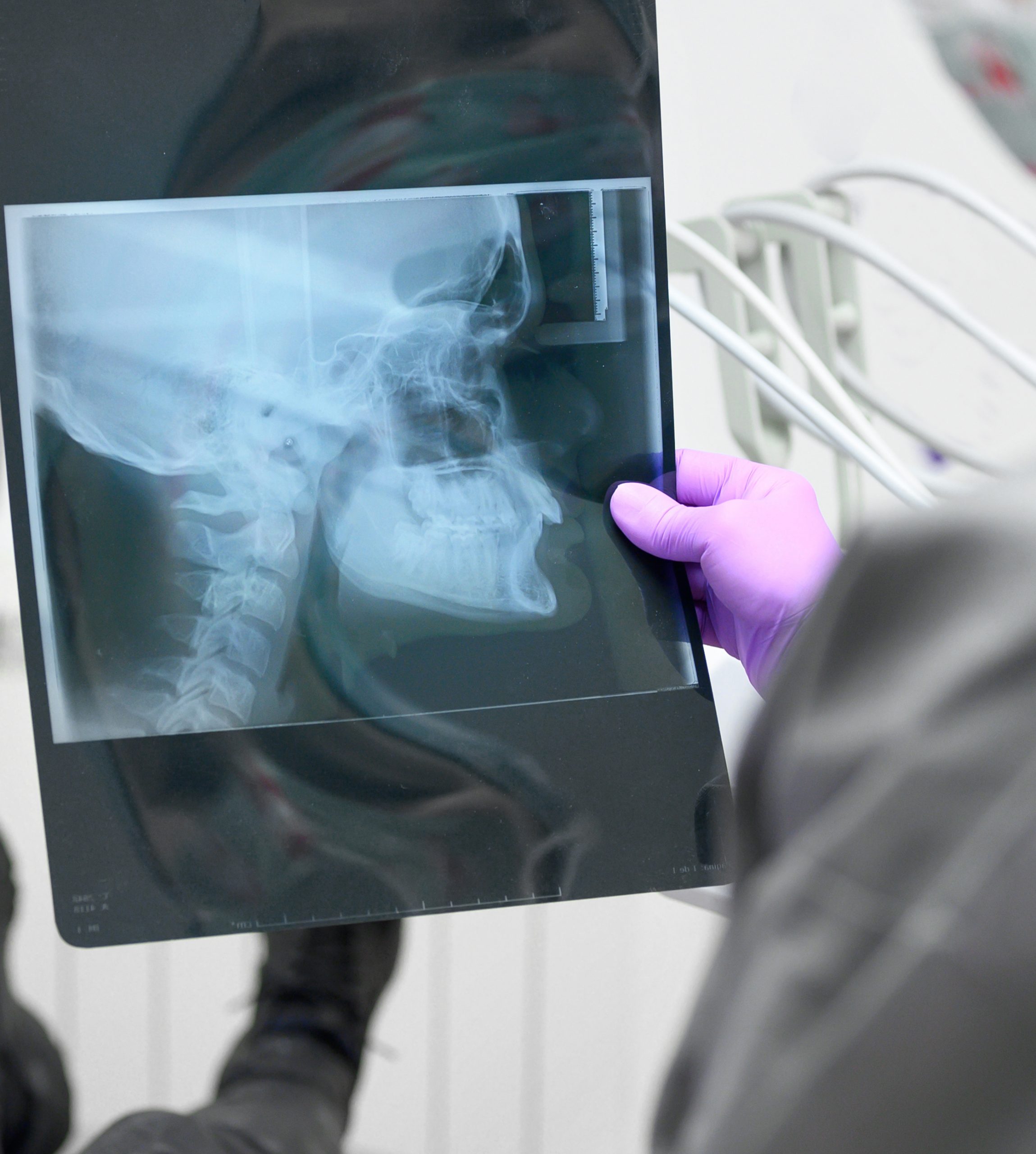 El curso sobre disfunciones de Atm (b) está dirigido principalmente a dentistas, pero puede ser interesante para sus técnicos dentales. Presentación en Power Point con vídeos. Aclaración de preguntas formuladas al final de la presentación.