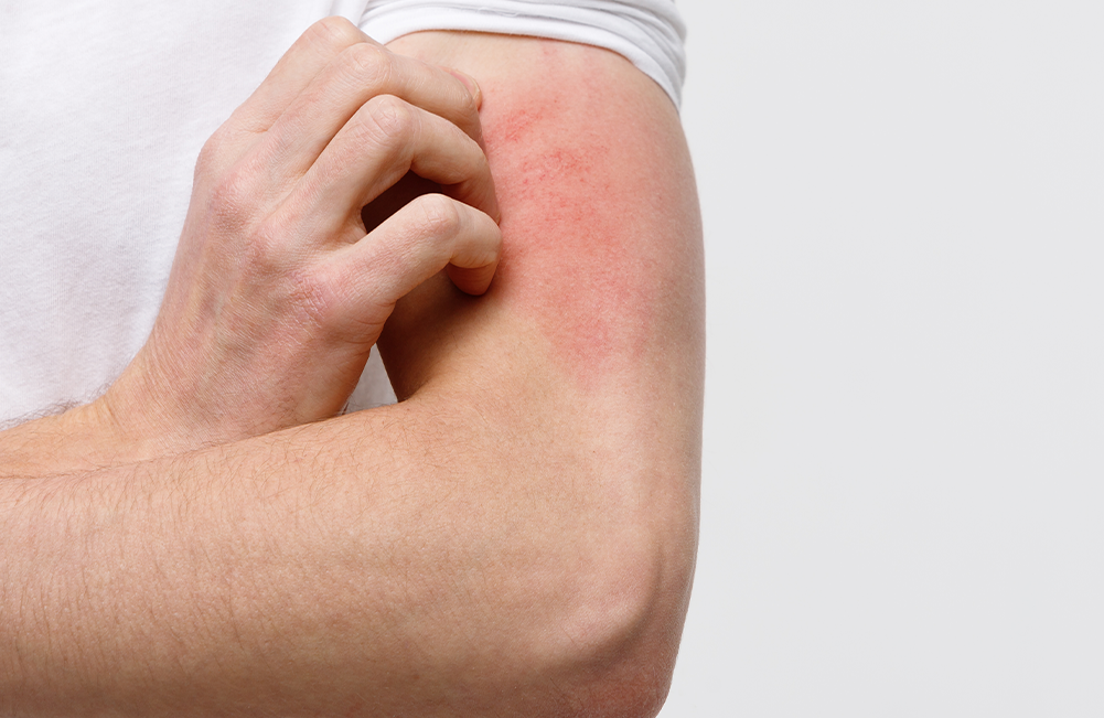 Estetica-y-salud-Bioptron