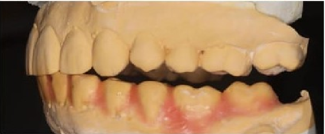fracaso en tratamiento de dolor de cabeza