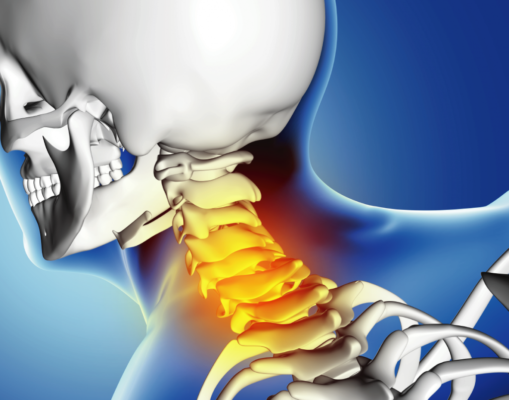 fracaso en tratamiento de dolor de cabeza