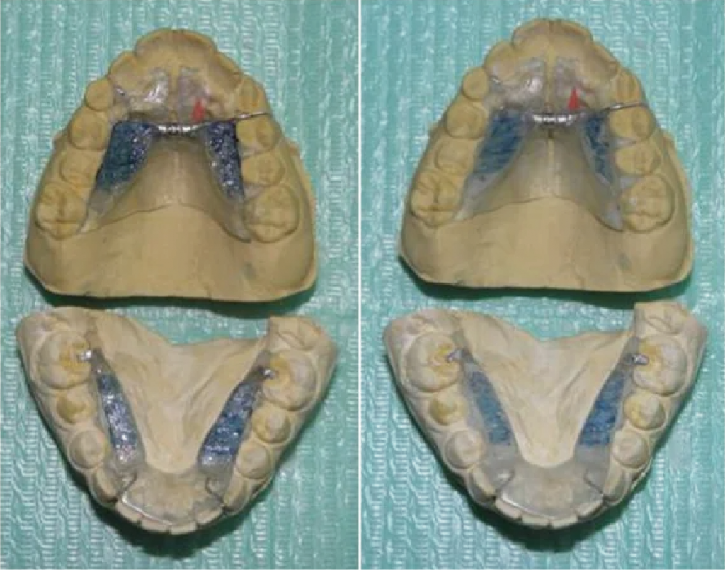 fracaso en tratamiento de dolor de cabeza